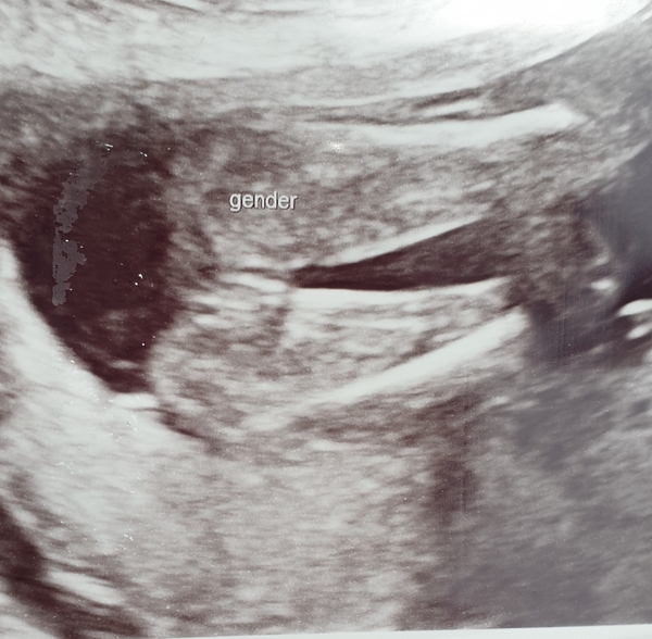 Boy or girl? I think you can tell...