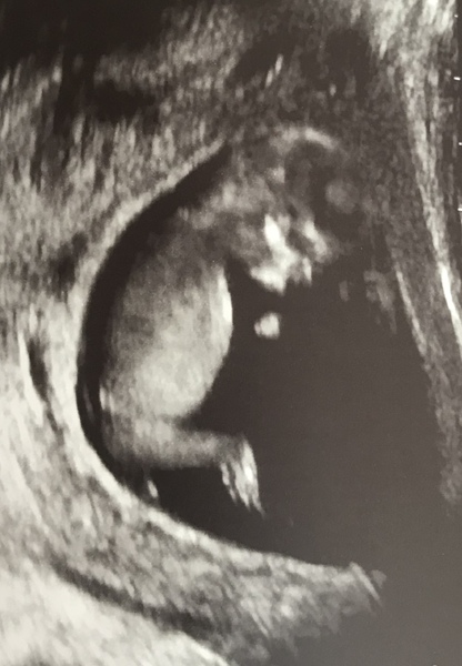 Christmas babies part 2