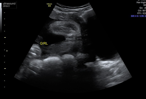 Boy or girl? I think you can tell...