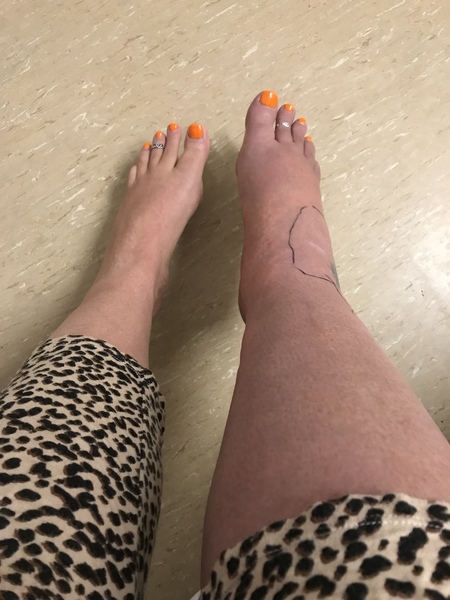 Does this look /sound like shingles? Something else?