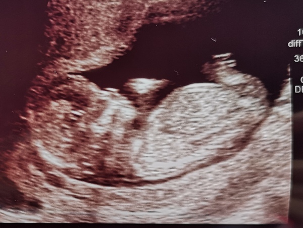 December 2019-Thread 2