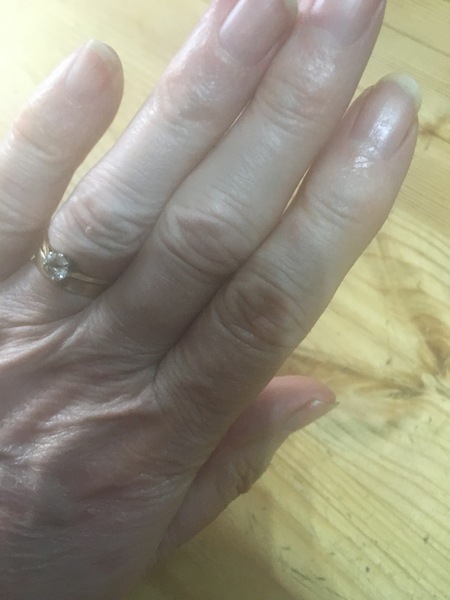 Can we start an anti "nail" campaign?