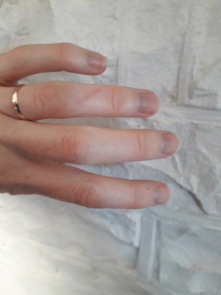Can we start an anti "nail" campaign?