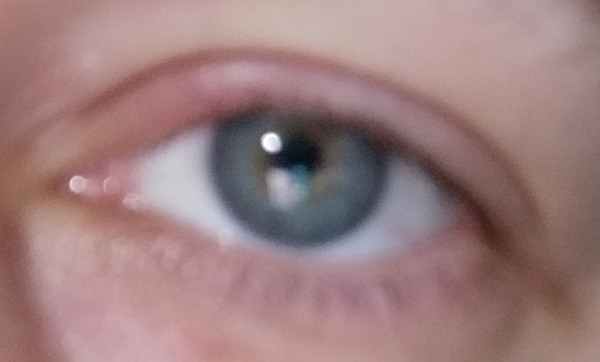 Start of a stye? Pic...