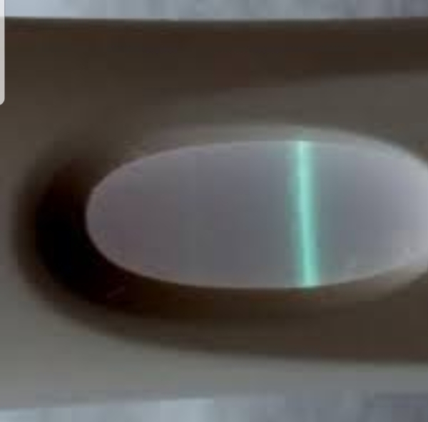 I think I just have line eyes but can anyone confirm it for me please