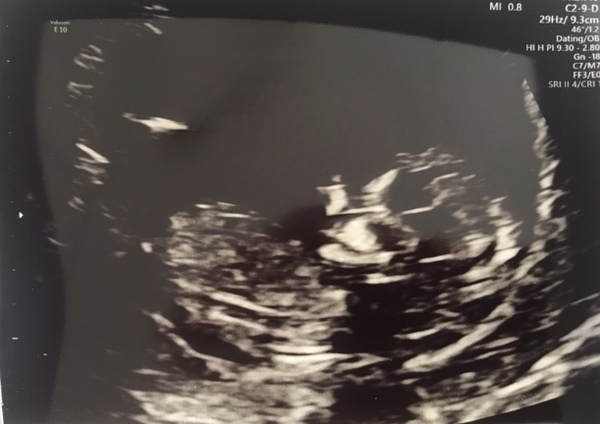 Due December 2019- continued