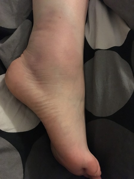 Not to have gone to doctor with this?