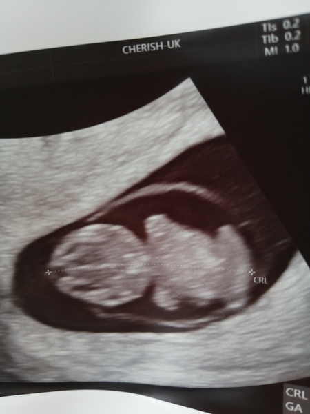 Catching up with those from TTC 1st baby - thread 4