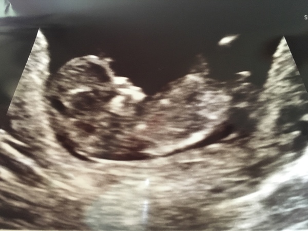 Is anyone else 9+ weeks?