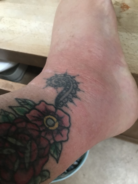 Does this look /sound like shingles? Something else?