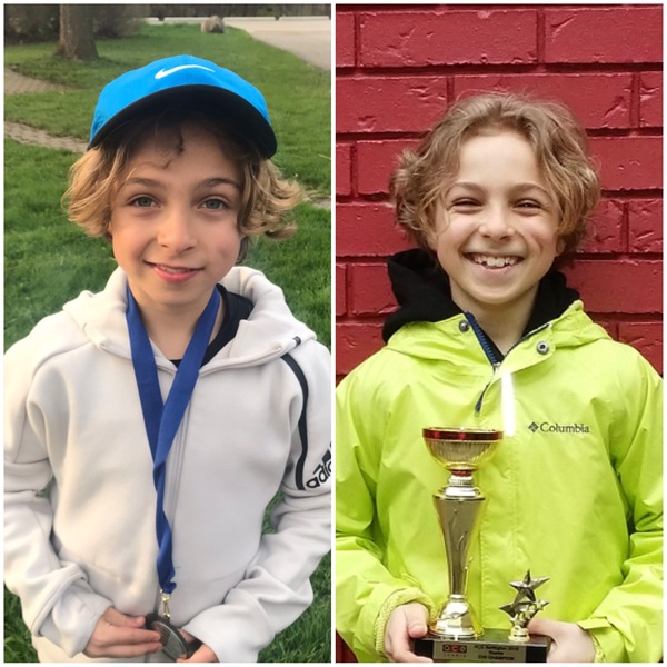 Dimple caused by cheek injury