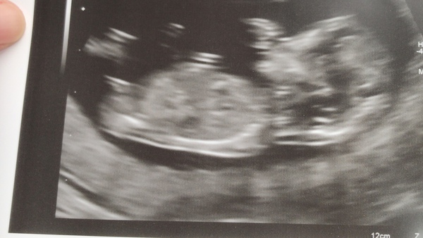 Christmas babies part 2