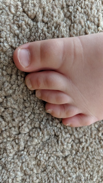 Should I be worried about DD's toes?