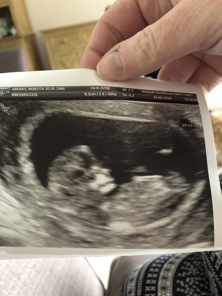 First scan- what should I expect?