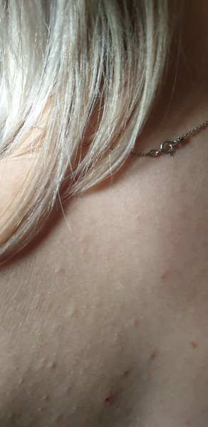Doctor keeps fobbing me off! Symptoms, anyone else?
