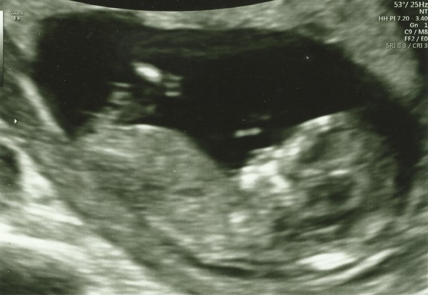 Feeling pregnant but no bfp yet