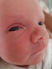 would you say this is conjunctivitis?
