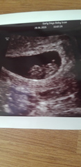 BFP - Anyone else due February 2020?