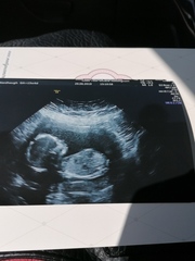 Christmas babies part 2