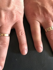 Opinions on this pinky finger