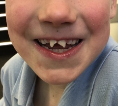 Can I 'add' to my teeth?