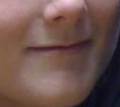 To hate lip fillers or is it only the bad ones that show?