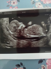Just for fun! Gender Guess x