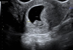 BFP - Anyone else due February 2020?