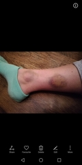 Aibu to expect police to do their job? Trigger... Attempted rape.