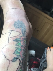 Does this look /sound like shingles? Something else?