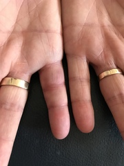Opinions on this pinky finger