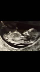 12 week gender guess please not sure seeing right nub 😂