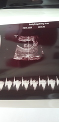 BFP - Anyone else due February 2020?