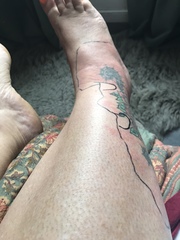 Does this look /sound like shingles? Something else?