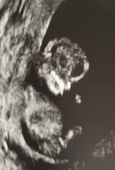 Christmas babies part 2