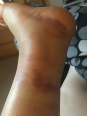 Not to have gone to doctor with this?