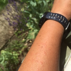 Suddenly allergic to the sun?
