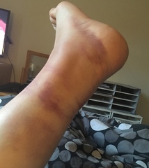 Not to have gone to doctor with this?