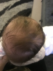 12 week old and flat head (pictures)