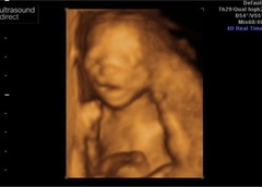 First Scan Picture