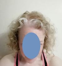 Going grey/white? [with pics]