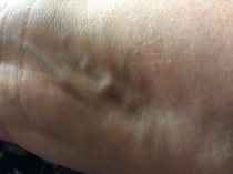 What are these lumps in my wrist?