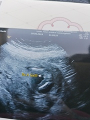 Christmas babies part 2