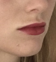 To hate lip fillers or is it only the bad ones that show?