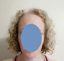 Going grey/white? [with pics]