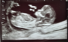 Boy/girl opinions please!!