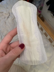 Early labour? **OP contains graphic image - Thread titled edited by MNHQ**