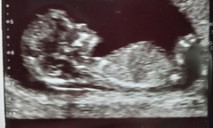 Boy/girl opinions please!!