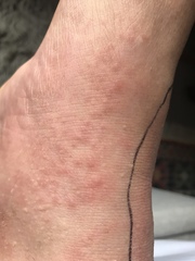 Does this look /sound like shingles? Something else?