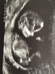 Christmas babies part 2